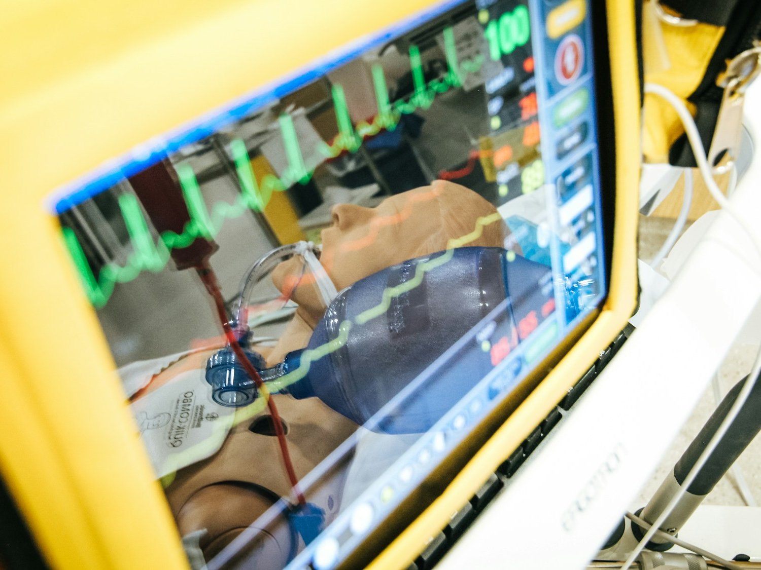 ECG-Expert — dispositiu desenvolupat per l'equip del grup CS&E