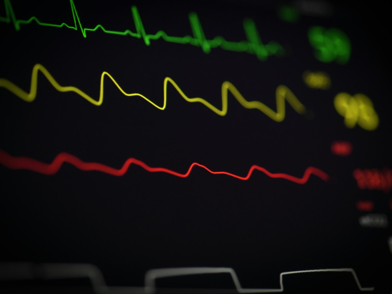 Plataforma europea d'anàlisi d'ECG d'esforç amb IA